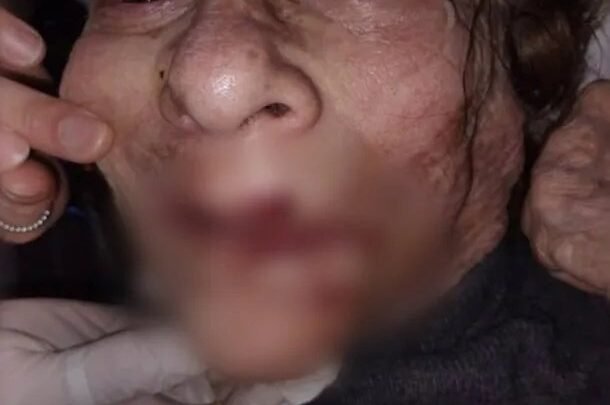 maltrato geriátrico Mar del Plata Investigan enfermero ancianas
