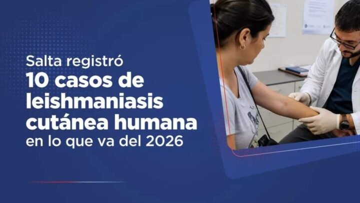 leishmaniasis cutánea humana