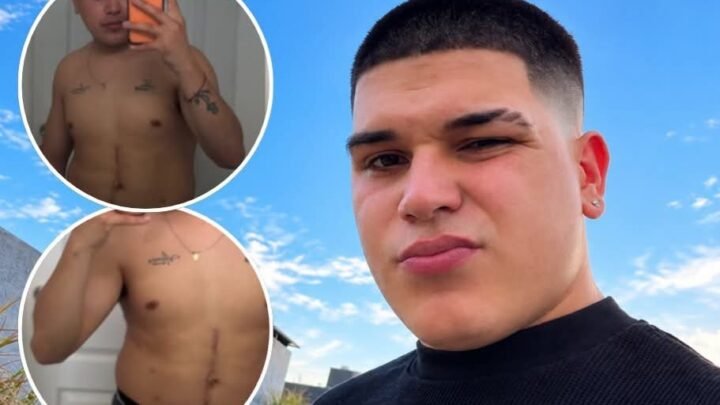 Thiago Medina compartió un mensaje sobre sus cicatrices tras el grave accidente que sufrió