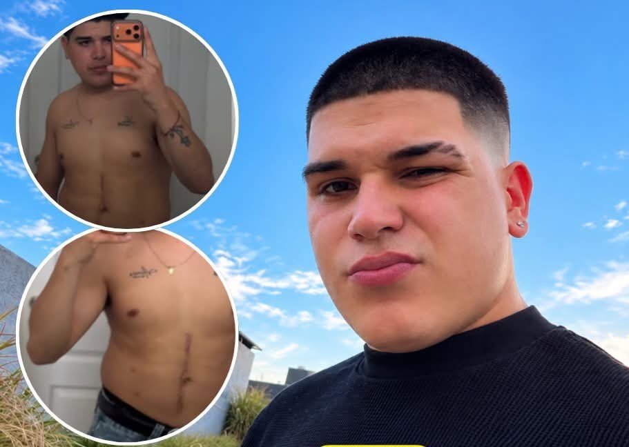 Thiago Medina compartió un mensaje sobre sus cicatrices tras el grave accidente que sufrió