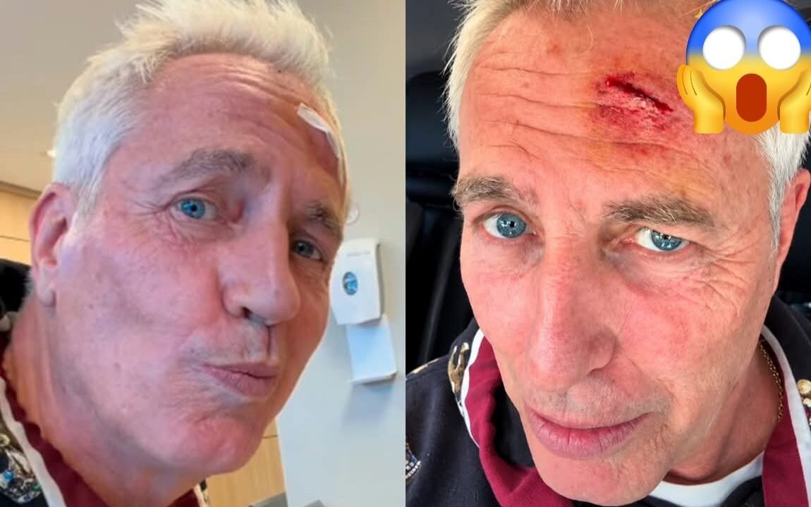 Marley sufrió un accidente doméstico y debió ser asistido tras golpearse la cabeza