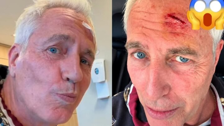Marley sufrió un accidente doméstico y debió ser asistido tras golpearse la cabeza
