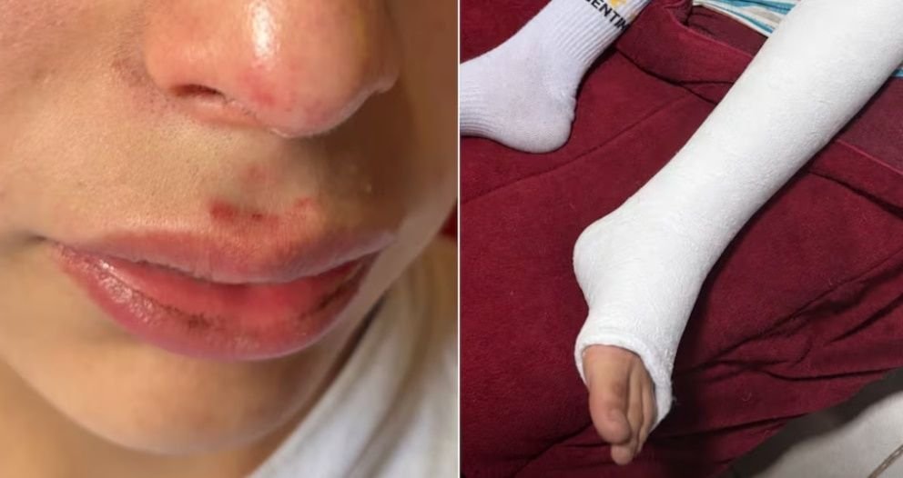 Detuvieron a un policía en Alta Gracia tras denuncias por golpiza y amenazas a dos adolescentes