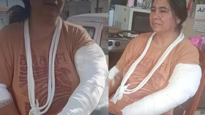 Ataque de dogos en Trelew: una mujer sufrió graves heridas y exige justicia tras el hecho