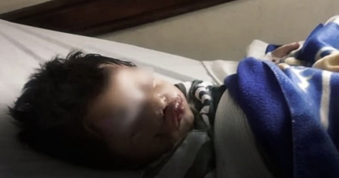 Un niño de 3 años fue atacado por un perro en barrio Ceferino y su familia solicita ayuda para su recuperación