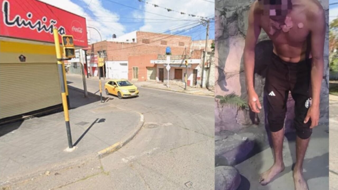 Detuvieron a una mujer por prender fuego a un joven que dormía en la calle en Jujuy