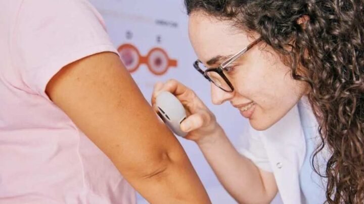 controles dermatológicos gratuitos