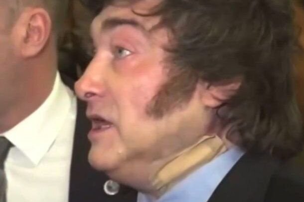 Escándalo en España: el apósito en el cuello de Javier Milei y su violenta arremetida contra la prensa
