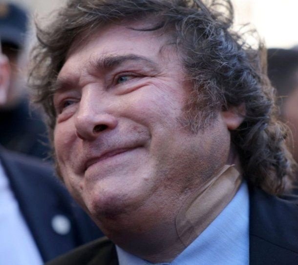 El misterio del apósito: la nueva versión sobre el accidente de Javier Milei en España